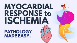 Myocardial Ischemia Pathology Simplified—Your Last Heart Attack [upl. by Ayalahs]