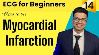 ECG for Beginners  How to see MYOCARDIAL INFARCTION in ECG  जानिए Evolution of MI in ECG [upl. by Beata318]