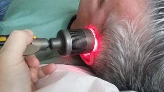 Treating tinnitus with soft laser [upl. by Aiekam]