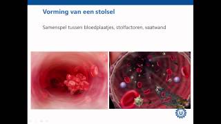 Hemostase deel 1 Inleiding  Prof dr REG Schutgens [upl. by Missak]