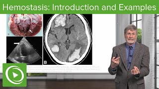 Hemostasis Introduction and Examples  Cellular Pathology [upl. by Hennebery896]