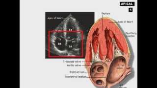 Echocardiography Introduction [upl. by Angelika]