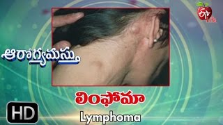 Aarogyamastu  Lymphoma  18th May 2017  ఆరోగ్యమస్తు [upl. by Antrim]