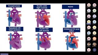 BayCare Presents Pediatric Cardiology to Adult Congenital Heart Disease [upl. by Dana516]