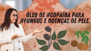 Como utilizar óleo de copaíba para fungos e doenças de pele COMPROVADO [upl. by Liahkim]