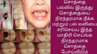 சொத்தை பல்லில் இருந்து நிரந்தரமாக சொத்தையை நீக்க இந்த மாதிரி செய்தால் போதும் [upl. by Henke]