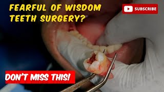 NonSurgical Wisdom Tooth Extraction 48Vertically Placed viralvideo youtubevideo wisdomteeth [upl. by Lletnuahs439]