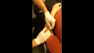 Extensor Carpi Radialis Longus and Brevis Dry Needling [upl. by Anitnahs944]