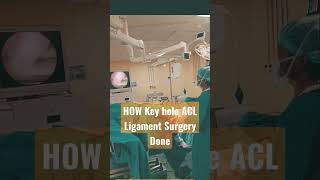 Inside The Knee Examination ✓✓✓  Knee Arthroscopy [upl. by Hercule]