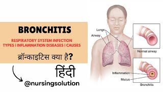 Bronchitis in hindi  Types  Causes  Symptoms  Respiratory tract infection in hindi [upl. by Marya]