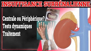 INSUFFISANCE SURRÉNALIENNE Symptomes Traitement Maladie dAddison  Endocrinologie Medicale [upl. by Raffin707]