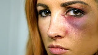 Becky Lynch learns she cant compete at Survivor Series WWE The Day Of [upl. by Nadia]