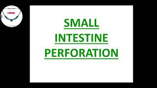 Small intestine perforation in hindi DEFINITION ETIOLOGY diagnostic evaluation MANAGEMENT [upl. by Paryavi885]