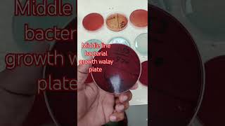 Bacterial growth walay plate onthisday music friend ship bacteriabacterialvaginosis bacterial [upl. by Cleon566]