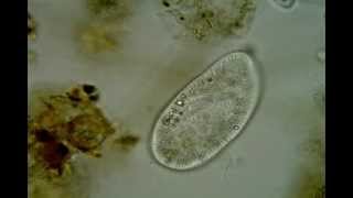 Paramecium putrinum Paramecium trichium [upl. by Yelah686]