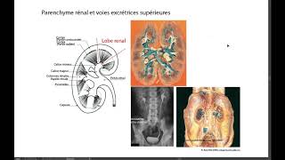 9 PARENCHYME ET VOIES EXCRÉTRICES SUPÉRIEURES [upl. by Aniraz]