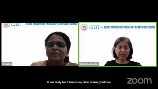 POST RENAL TRANSPLANT DE NOVO GLOMERULAR DISEASES Dr Shaila Khubchandani Lec 5 [upl. by Bradan]