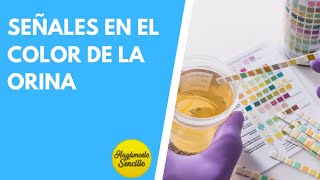 ¿QUÉ NOS DICE EL COLOR DE LA ORINA DE LA SALUD DEL NIÑO [upl. by Nayar]