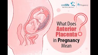 Anterior Placenta  common condition in pregnancy [upl. by Adnirb700]