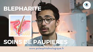 Blépharite  soins de paupières  Pole Ophtalmologique [upl. by Nivek]