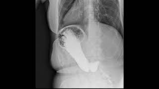 Dynamic XRay Retrospective View of Abdominal Motion  Konica Minolta Healthcare [upl. by Assenad773]