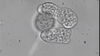 Entamoeba histolytica trophozoites [upl. by Oicram388]