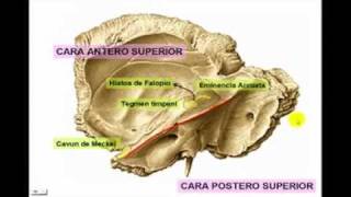 Osteología del Craneo parte 4 hueso temporal [upl. by Kent]