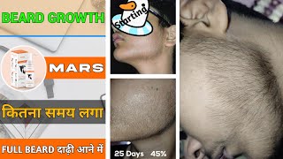 BEARD GROWTH  Full beard दाढ़ी आने में कितना समय लगता है Best soulation for beard growth [upl. by Wolfram587]