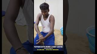 elbow dislocation treatment  முழங்கை மூட்டு விலகல்  vadapalani  puttur kattu [upl. by Oicnerual]