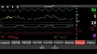 Pulseless Electrical Activity [upl. by Notsud739]