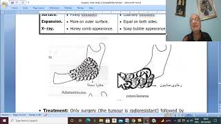 Surgical disorders of tongue and jaw in Arabic 5 Adamantinoma   by Dr Wahdan [upl. by Katerine]