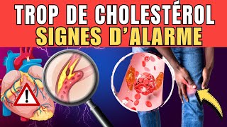 🚨 CHOLESTÉROL ÉLEVÉ  8 signes dalerte à surveiller de près [upl. by Meesak]