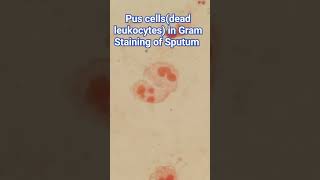 Pus cells  dead leukocytes Gram Staining of Sputum Microscopy at various magnifications [upl. by Chance175]