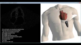 How to get the standard transthoracic echocardiography TTE views [upl. by Fredelia]