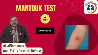 Mantoux Test मंटौक्स टेस्ट or Tuberculin Skin Test I डॉ अंकित पारख बाल टीबी और छाती विशेषज् [upl. by Acirem]