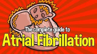 Complete Guide To Atrial Fibrillation Causes symptoms and treatments [upl. by Bostow311]