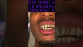 Quavo Shows Off Teeth Without Grill 😳 [upl. by Cotter722]