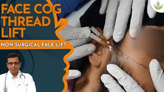 Face Cog Thread Lift in Delhi  Non Surgical Face Lift  Care Well Medical Centre [upl. by Frieder]