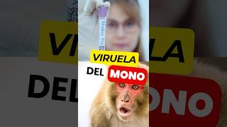 ¿EXISTE algún Tratamiento Eficaz para la VIRUELA del MONO 🙊 💉 virueladelmono mpox [upl. by Duke]