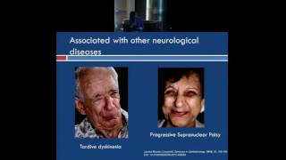 Overview of Blepharospasm and Other Neurological Eye Disorders [upl. by Ennybor552]