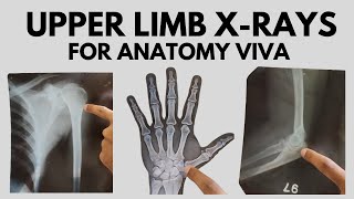 Upper Limb Radiological Anatomy  For Anatomy Viva [upl. by Yhtnomit650]