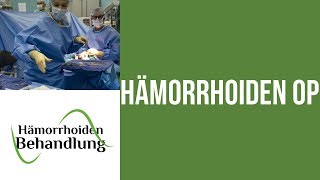 Hämorrhoiden OP  Welche Möglichkeiten gibt es für dich  Hämorrhoiden Operation [upl. by Zildjian]