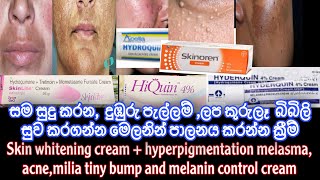 Skin whitening ඕනඅයට creamඑකක් සහ hyperpigmentation melasma‘acnemiliaතියනඅයටත් medicated cream [upl. by Ueik]