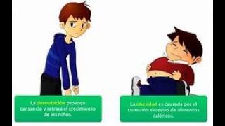 NFAP1 U3 EA MACHFISIOPATOLOGIA DE OBESIDAD Y DESNUTRICION [upl. by Frodine]