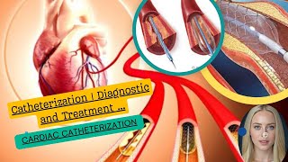 Cardiac Catheterization Purpose Procedure and Recovery [upl. by Eckart]