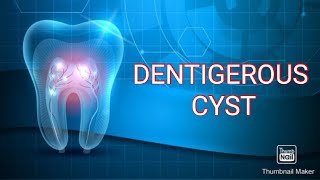 DENTIGEROUS CYST [upl. by Eserehc]