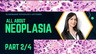 All About Neoplasia  From Beginners to Pro in diagnosis  Part 24 [upl. by Oderfodog698]