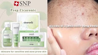 Review SNP Prep CICARONIC  Skincare untuk Jerawat Kulit Sensitif ENG SUB [upl. by Devine]