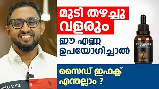 മുടി തഴച്ചു വളരും ഈ എണ്ണ ഉപയോഗിച്ചാൽ മതി  Minoxidil Side Effects  Dr varun Nambiar [upl. by Tsai]