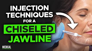 How to Get Rid of Jowls with Filler  Full Procedure Demonstration [upl. by Waine]